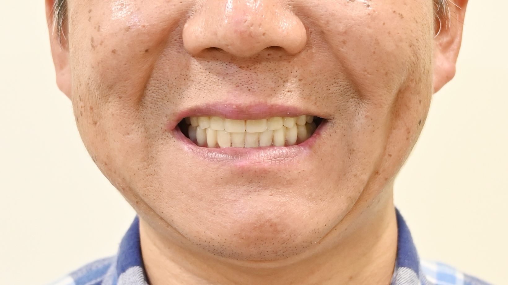 重拾笑容的那一天：張伯伯的一日重建之旅